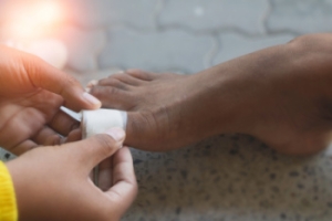 Preventing Foot Blisters